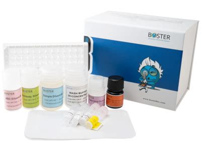 antinuclear antibody elisa kit|ANA ELISA Kits .